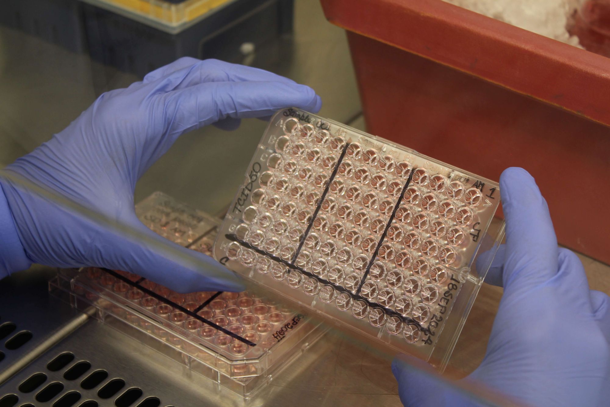 hVIVO_LabServices_TCID50